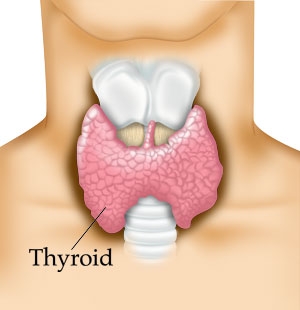 Hipotiroidismul - afectiunile tiroidei